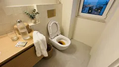 Urina escura: 8 causas comuns e quando deve procurar ajuda